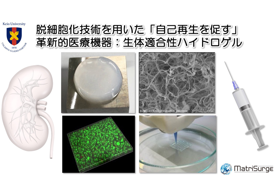 「自己再生を促す」 生体適合性ハイドロゲル