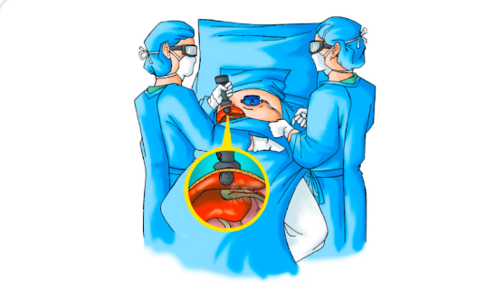 Innovations in the field of Laparoscopic Surgery.