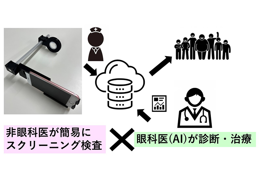 スマートフォン接続型眼底カメラとAI遠隔診断治療体制の構築