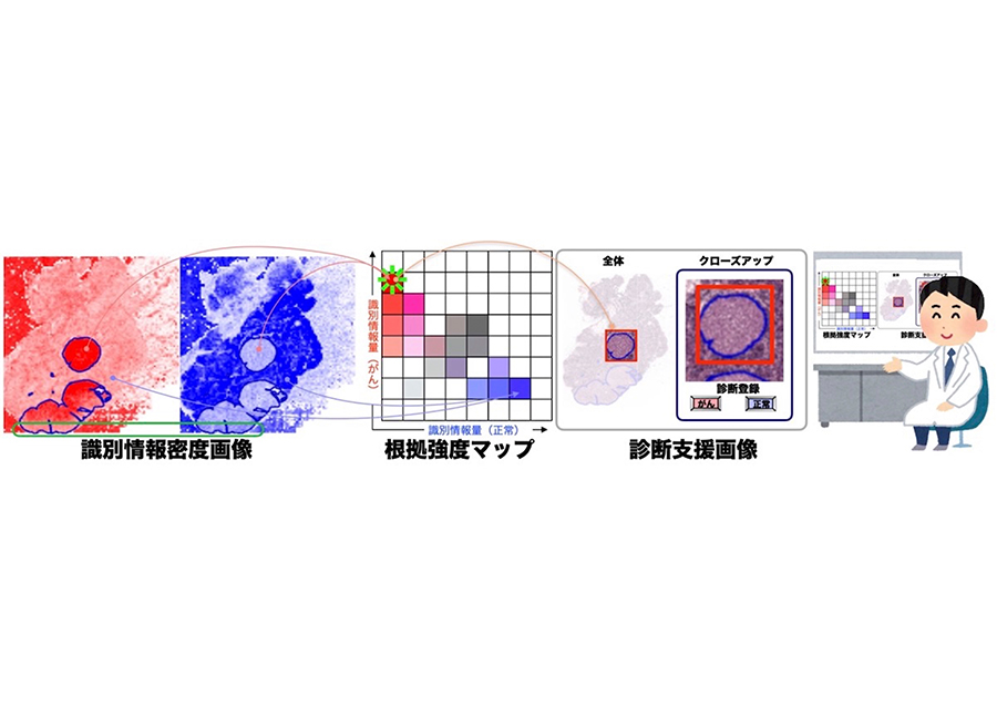 Pathological image diagnosis artificial intelligence technology that can present the basis for decision-making