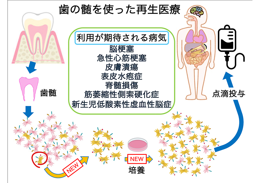 歯髄幹細胞由来MUSE細胞を用いた究極の再生医療